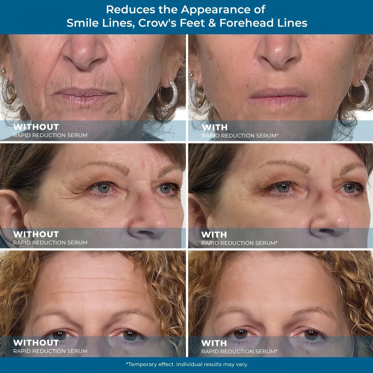 Plexaderm Rapid Reduction Serum - Visibly Reduces Under-Eye Bags & Wrinkles | Instant eye serum that visibly reduces under-eye bags, puffiness, wrinkles & dark circles in minutes